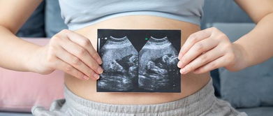 孕期尿常规主要看哪几项