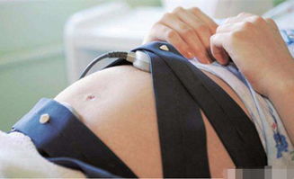 胎心监测的目的及正常胎心率范围