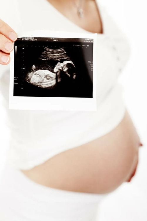 b超检查胎儿发育不良，还可以要吗